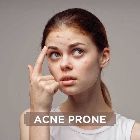 Acne Skin Care Solution
