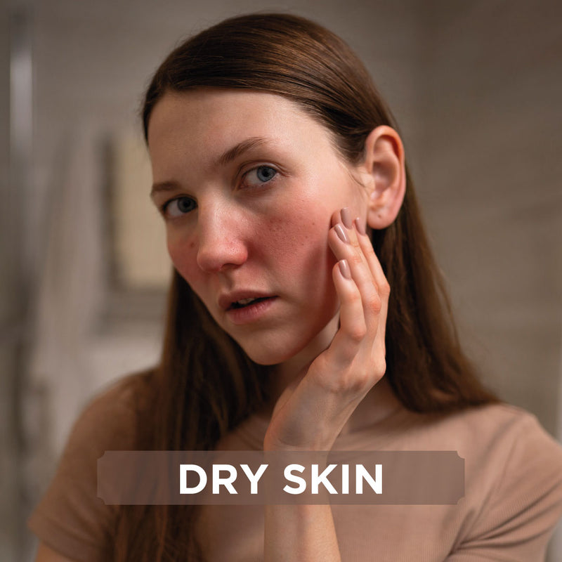 Dry Skin
