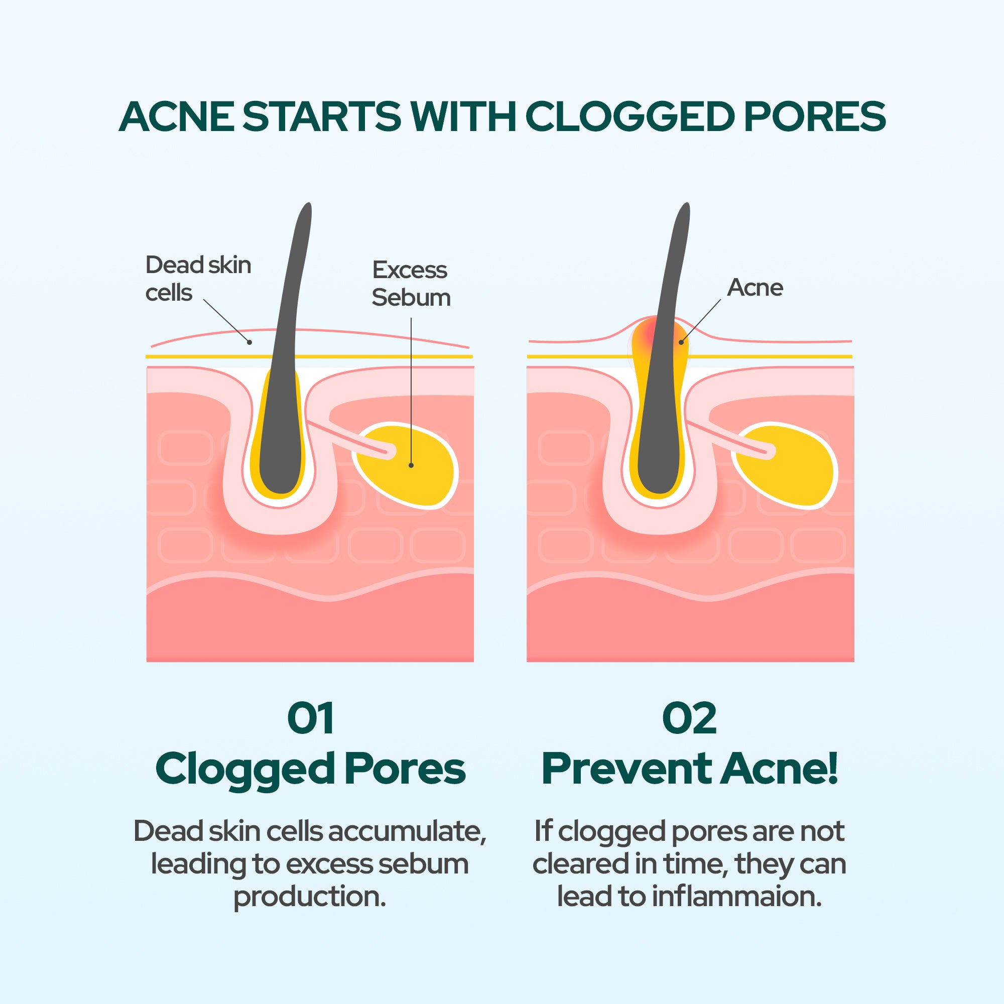 Dr Belmeur AHA/PHA Exfoliating Toner 100ml - Pore Refining Toner