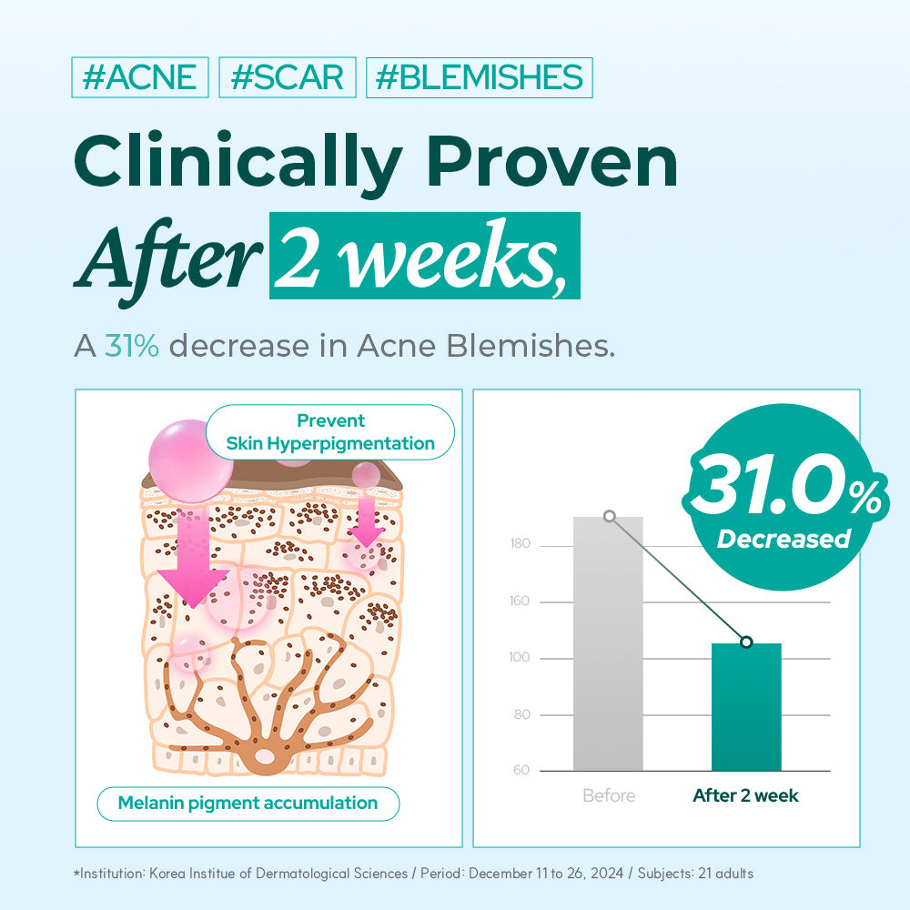 Dr Belmeur Niacinamide & Tranxemic Acid Dark Spot Serum 30ml - Prevent Hyperpigmentation & Sun Spots