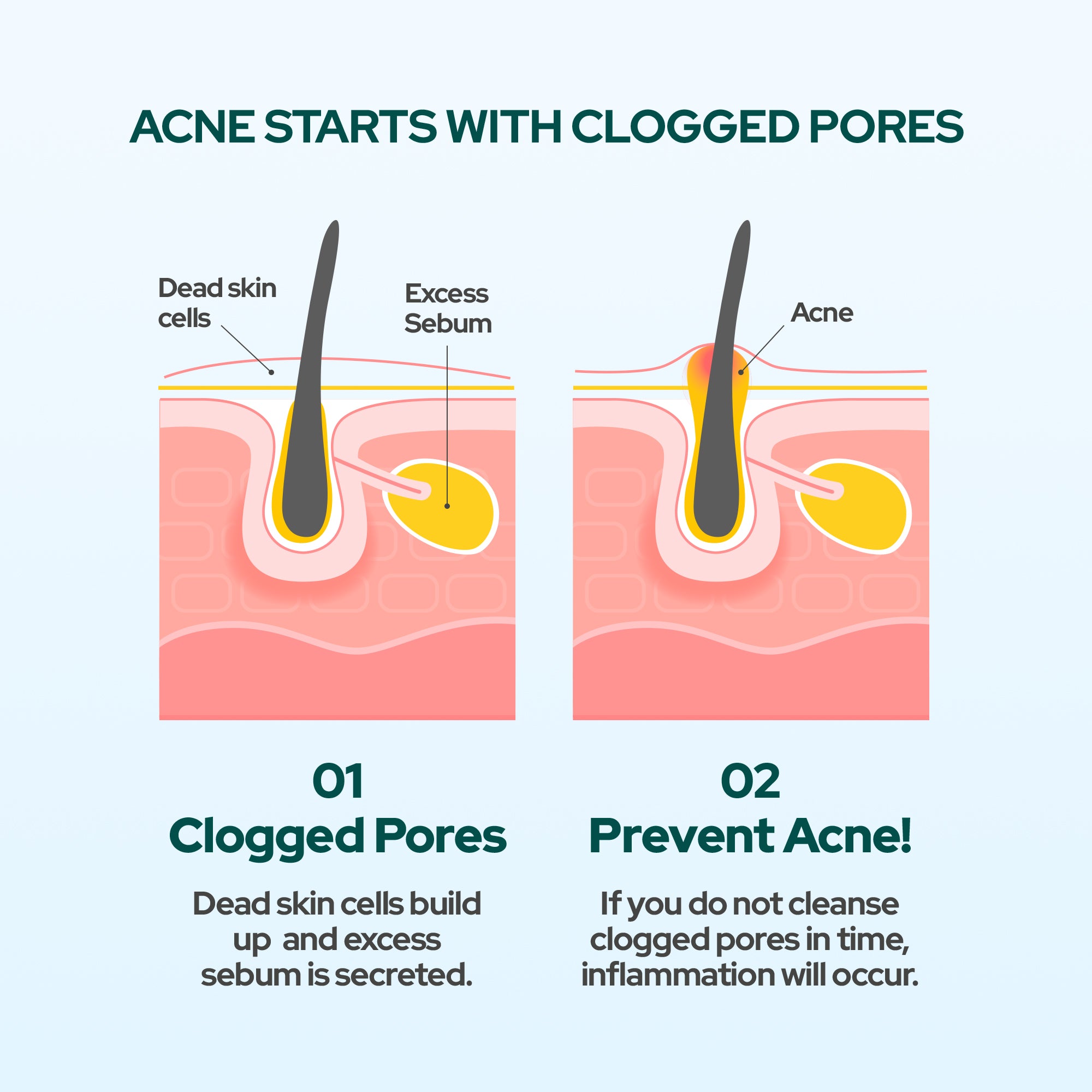 Dr Belmeur AHA/BHA Sebum Control Gel Cleanser 100ml - For Oily Skin