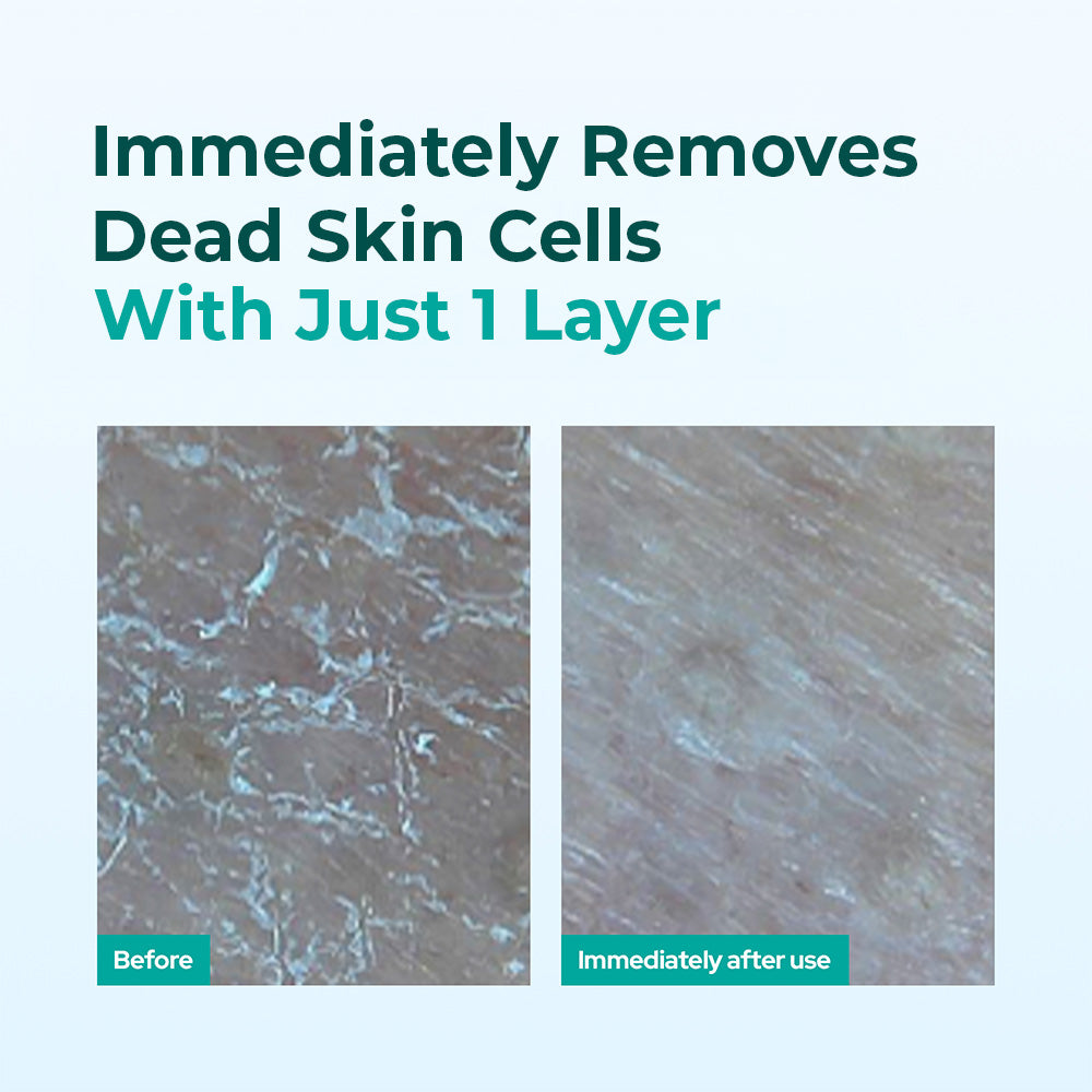 Dr Belmeur AHA/PHA Exfoliating Toner 100ml - Pore Refining Toner